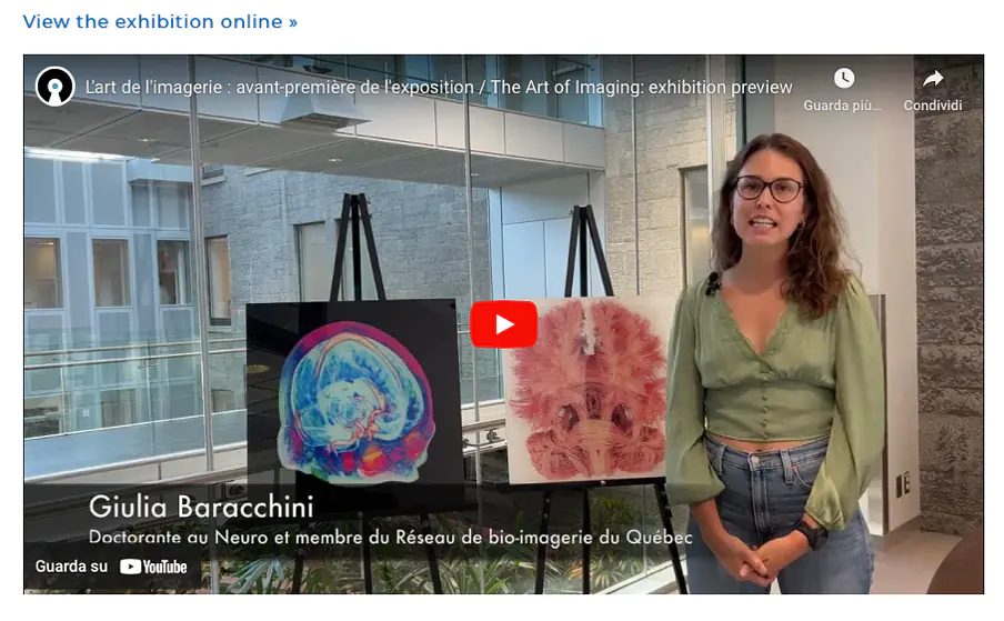 Promotional video for an art exhibition I co-organised on Brain Art in Montreal, Canada