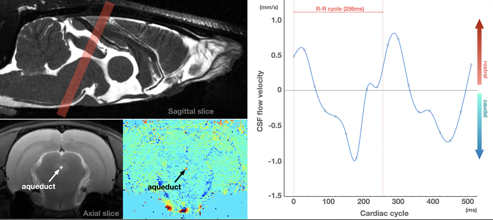 Rat CSF Flow with Phase Contrast