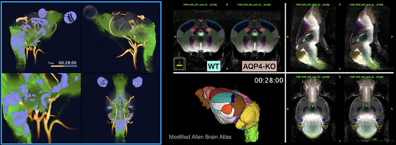 Dynamic Contrast Enhanced MRI