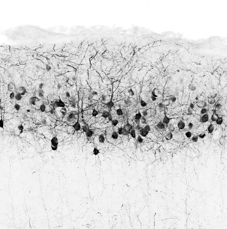 In utero electroporation with GFP marks pyramidal neurons in the cortex.