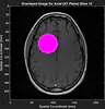 Computing in Medicine - Computational MRI and Digital Image processing