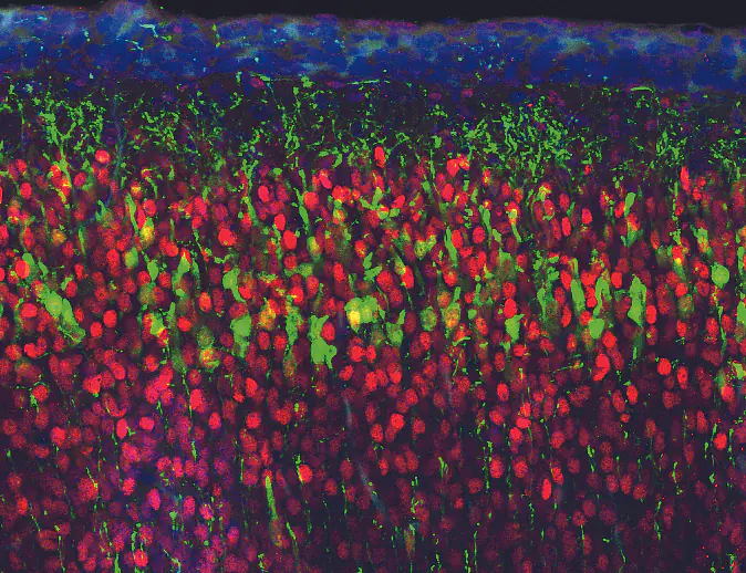In utero electroporation with GFP marks pyramidal neurons in the cortex. Red: immunohistchemistry for layer marker Brn2.