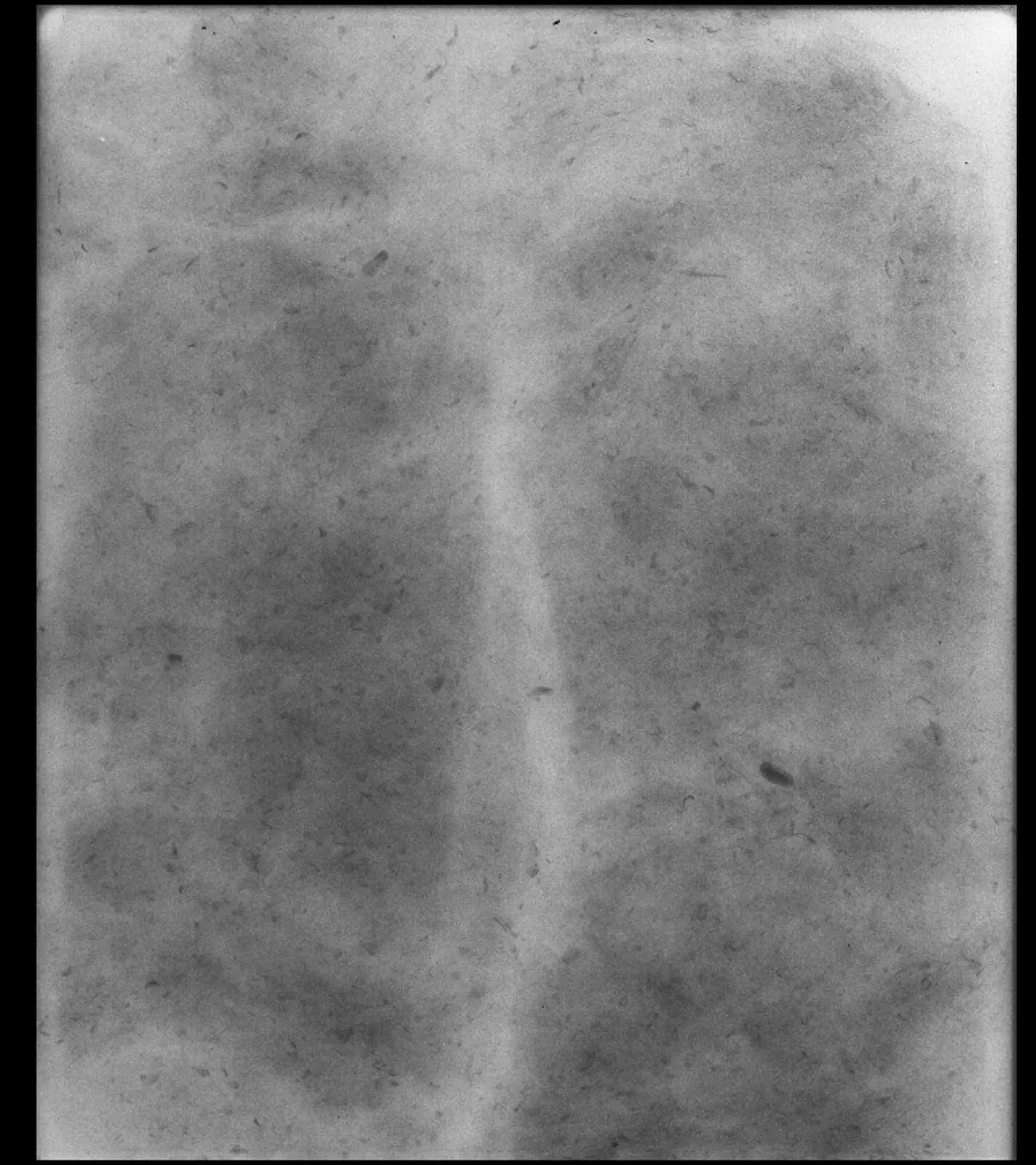 Sample X-ray image with various trash types
