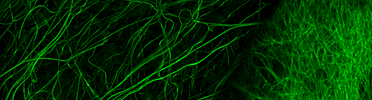 Banner image placeholder