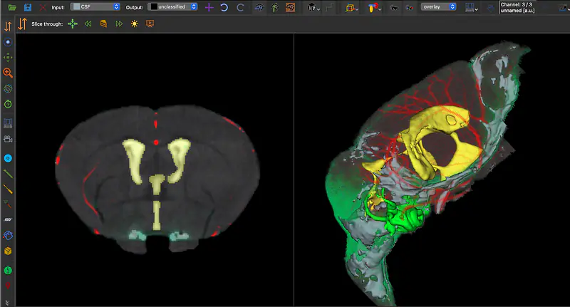 Mouse Brain Cisternography