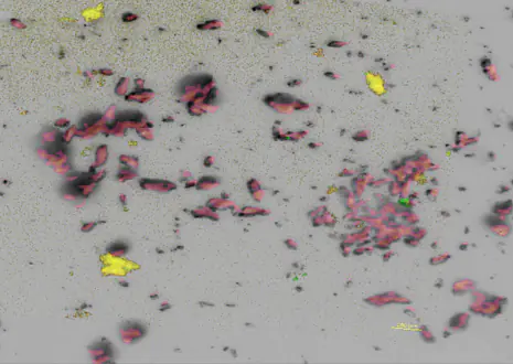 Multimodal overlay of optical image, FISH microscopy and synchrotron XRF of microbial consortia (collaboration with V. Orphan and J. Magyar, Caltech)