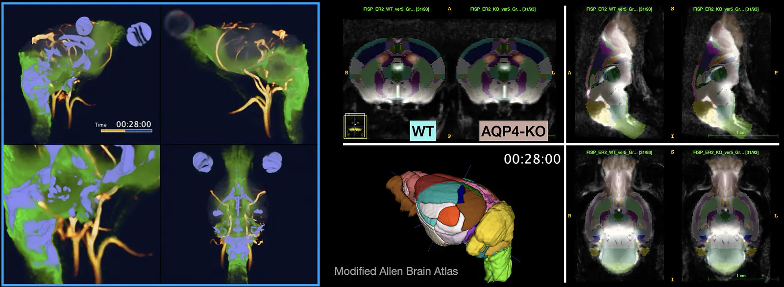 Dynamic Contrast Enhanced MRI