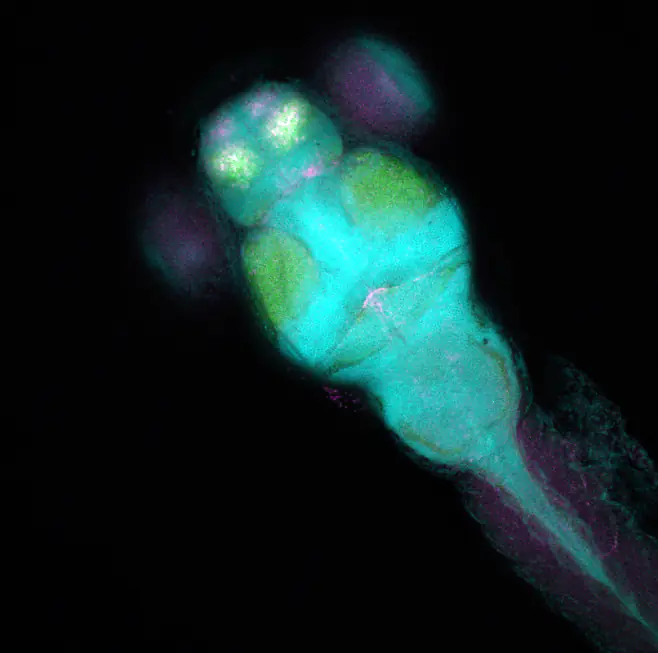 Merged with DAPI staining
