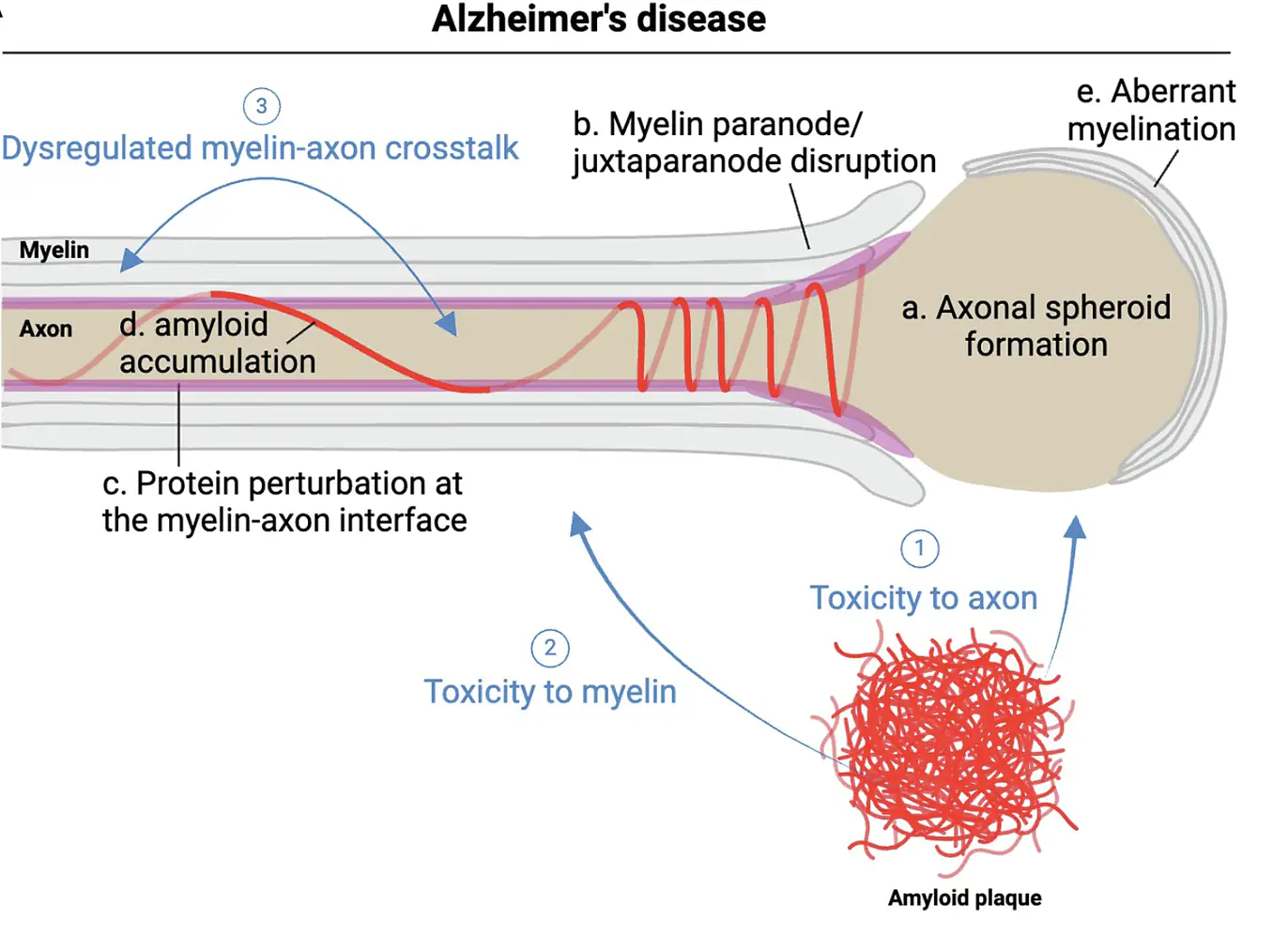 Myelin-axon pathology in Alzheimer's disease