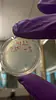 Plate with M13 bacteriophage. Each dot on the plate is a phage-forming unit (PFU).