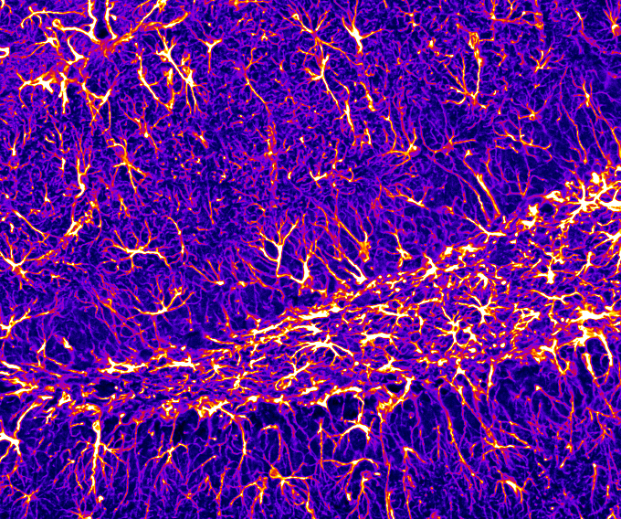 Astrocytes in the mouse hippocampus