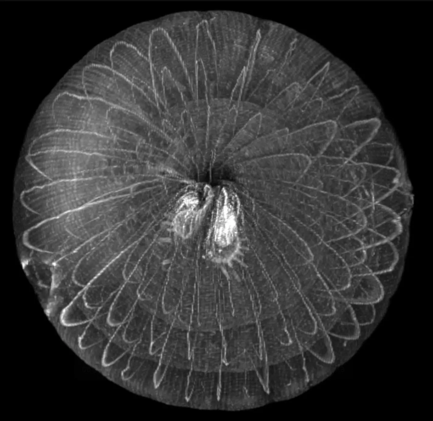Onion (3D-MIP)