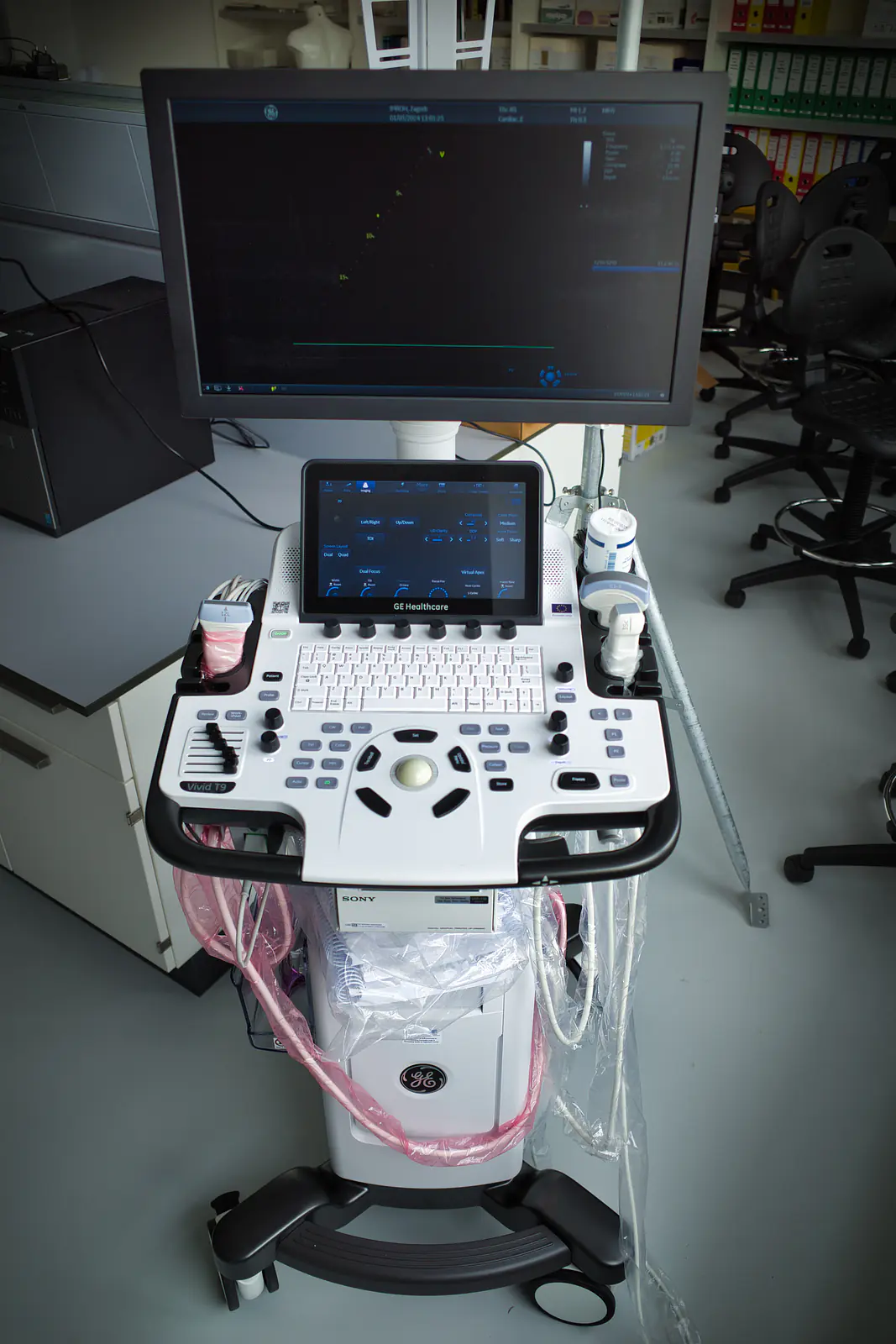 Ultrasound imaging system