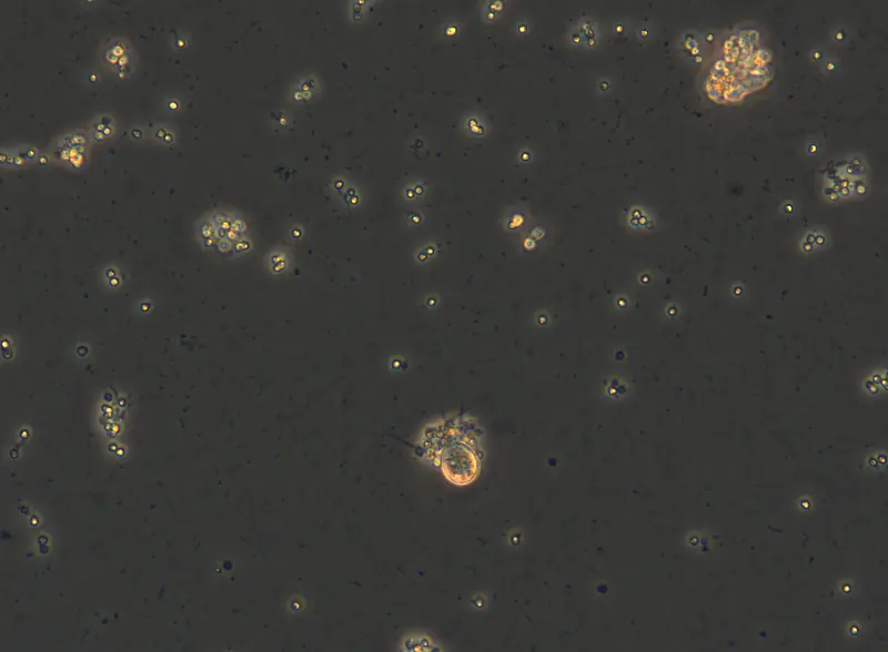 Cryptodifflugia operculata interacting with   Plasmodiophora brassicae