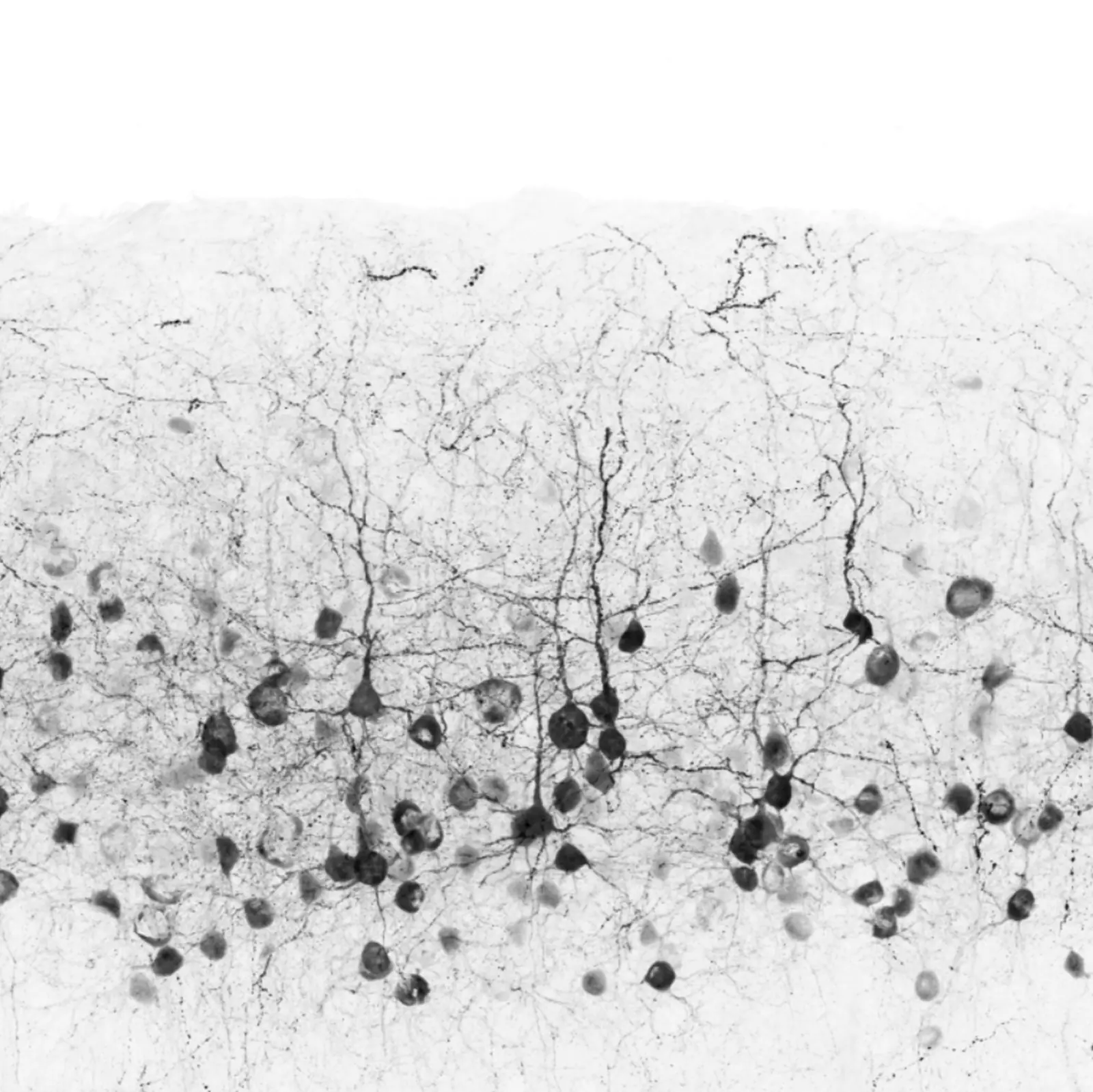 In utero electroporation with GFP marks pyramidal neurons in the cortex.