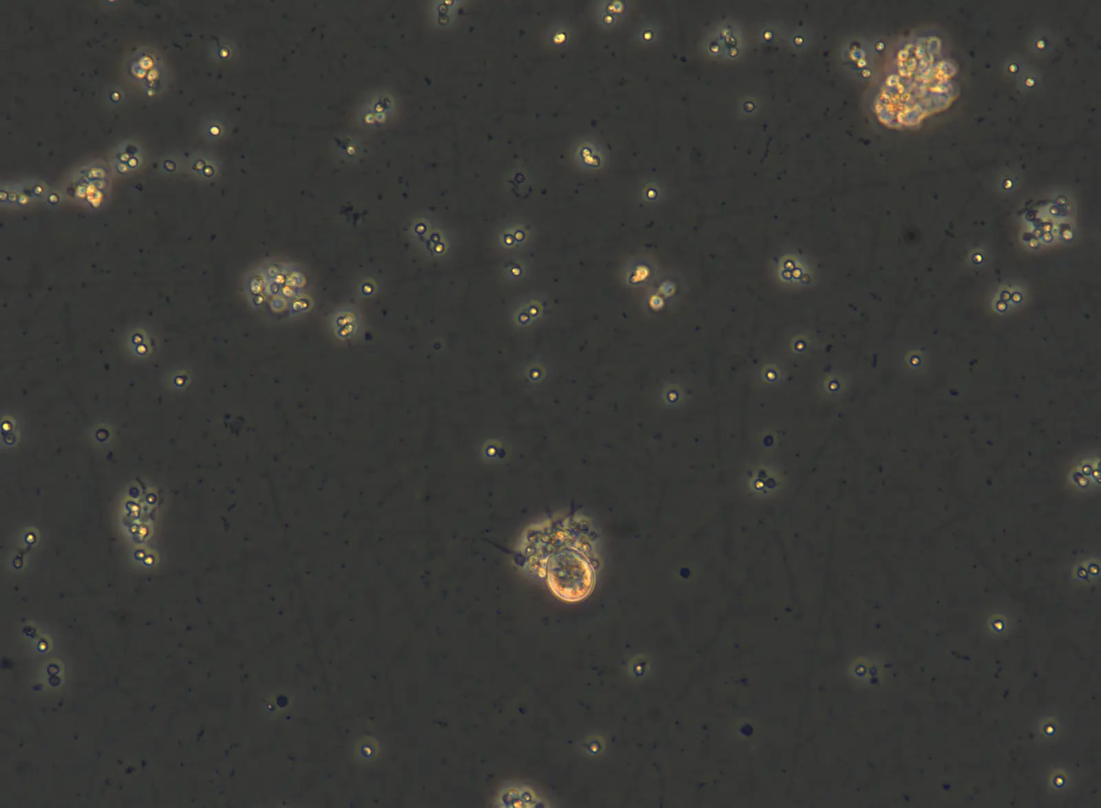 Cryptodifflugia operculata interacting with   Plasmodiophora brassicae