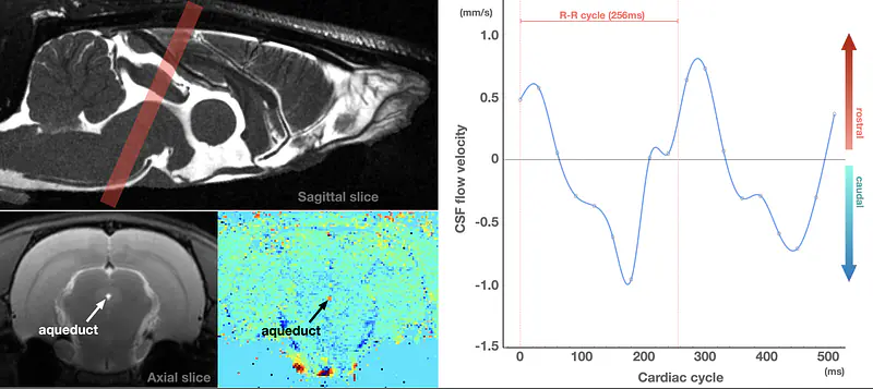 Rat CSF Flow with Phase Contrast