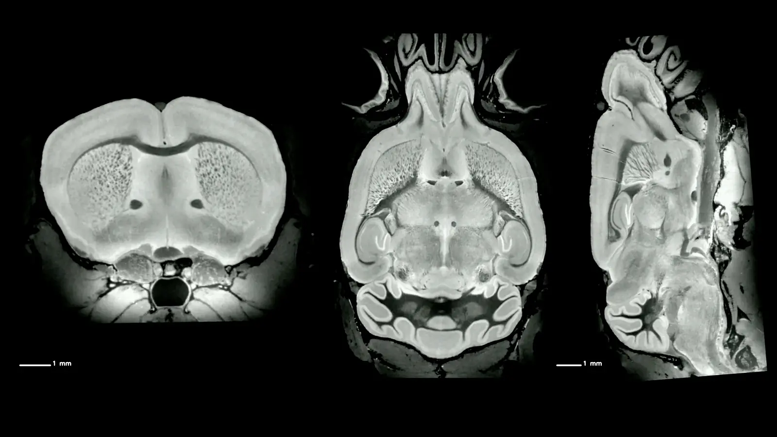 Mouse Brain Anatomy