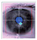 Pupillometry 