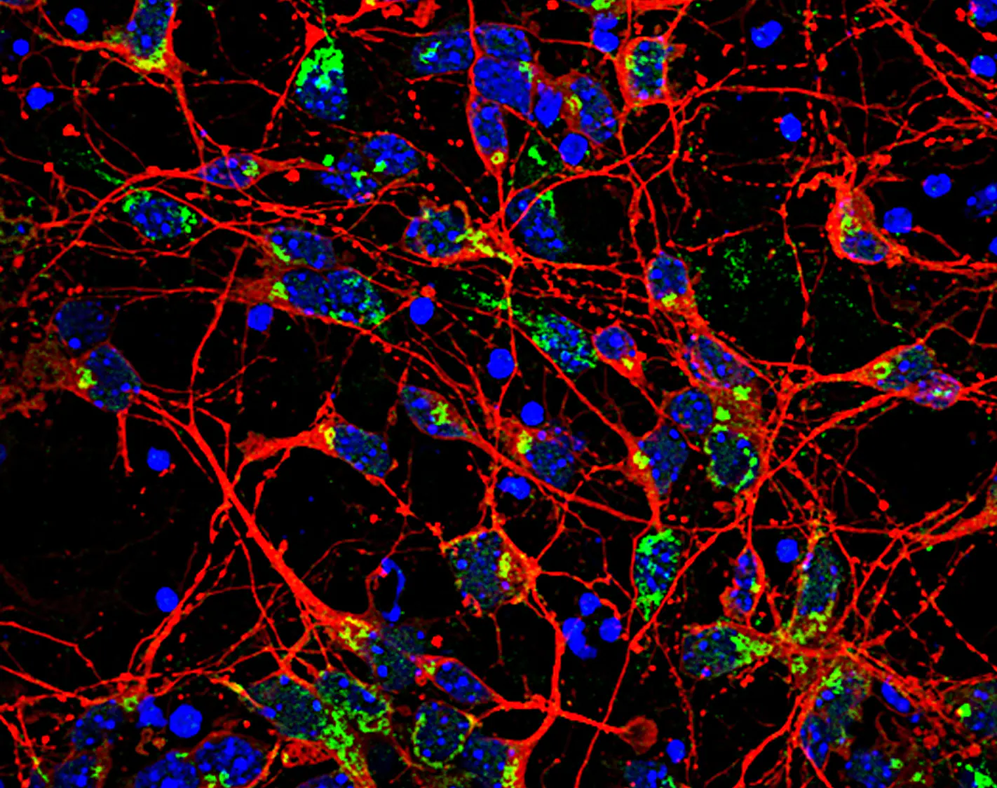 Primary cortical neurons