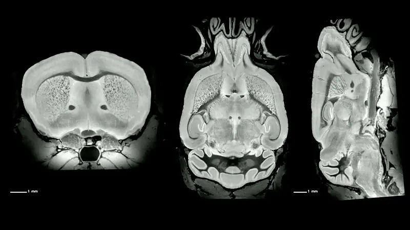 Mouse Brain Anatomy