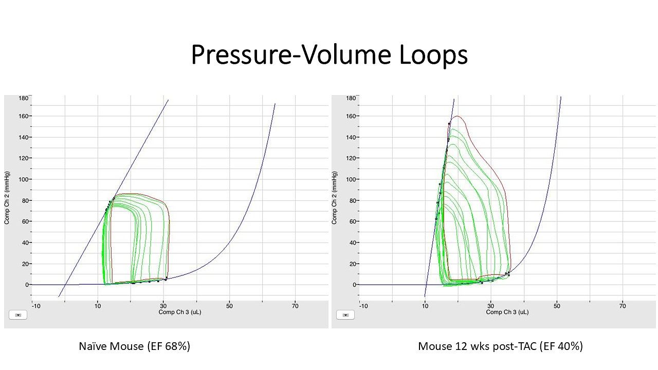Images of data analyses of PV loops of normal and heart failure mice.
