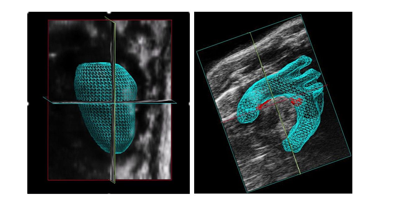 Pictures of mouse heart and vessels generated in the Core with the F2 ultrasound.