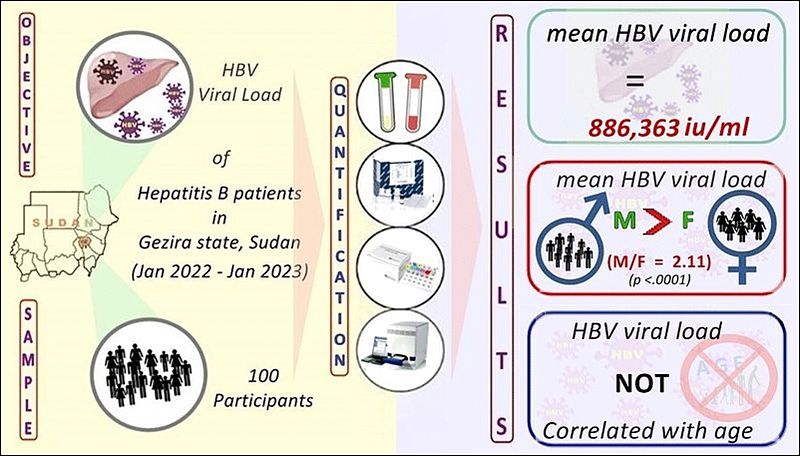 Quantification of hepatitis B viral load in patients attending healthcare facilities in Gezira state, Sudan