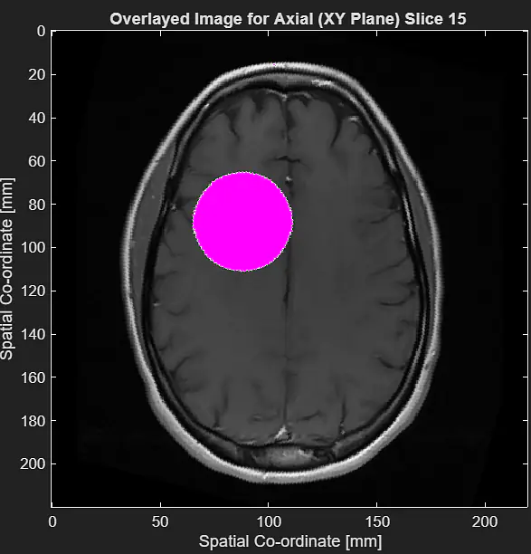 Computing in Medicine - Computational MRI and Digital Image processing