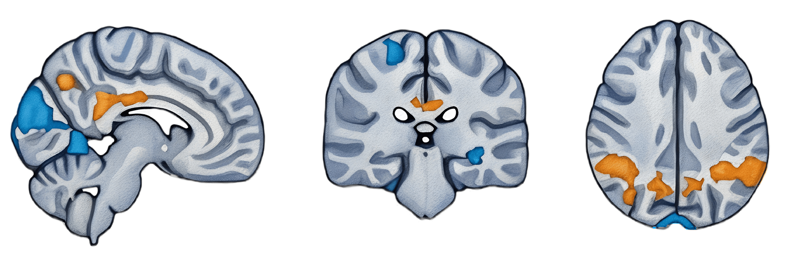 An artistic stylized image of a brain with colored areas of activation