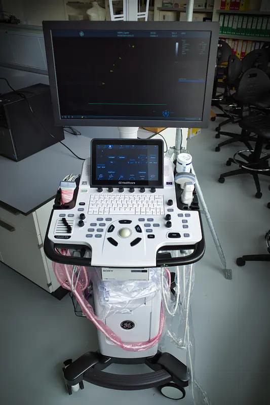 Ultrasound imaging system