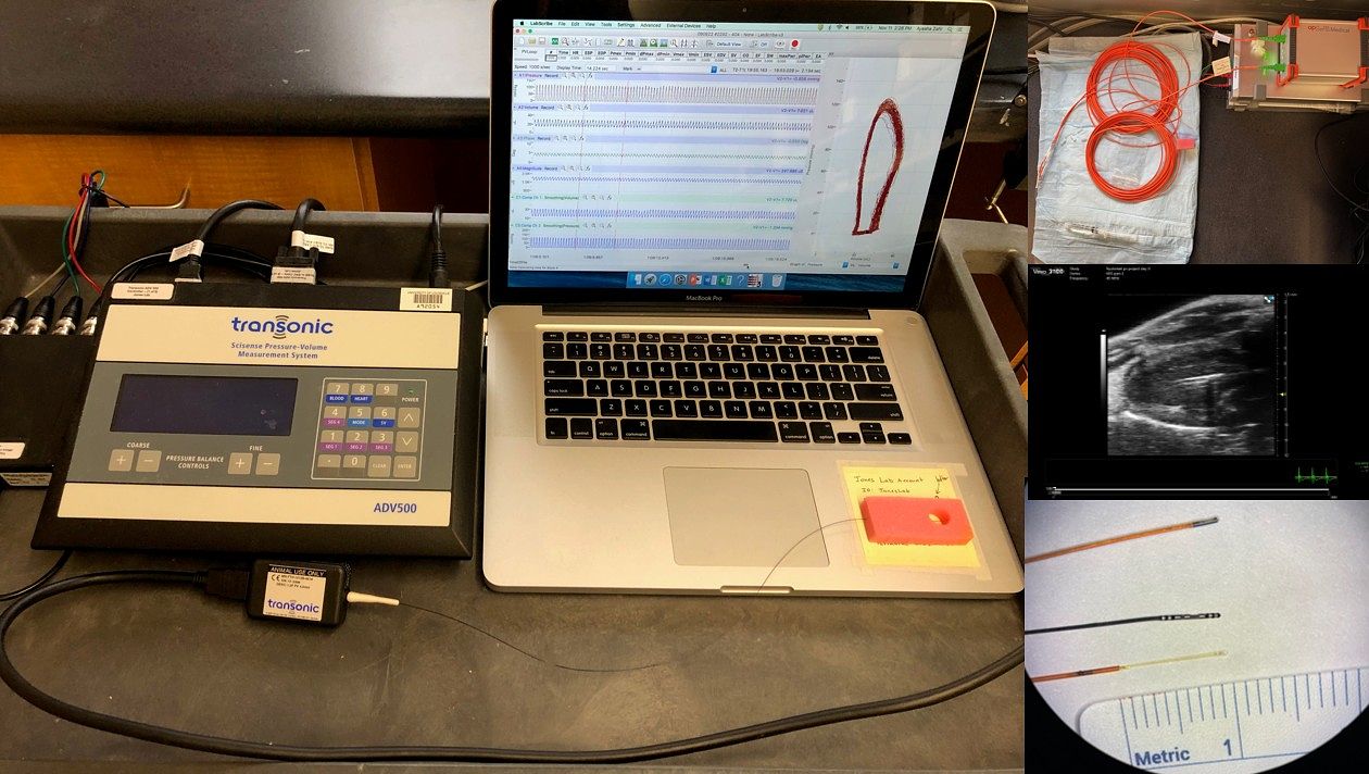 Picture of the PV loop catheter, along with associated hardware and software.