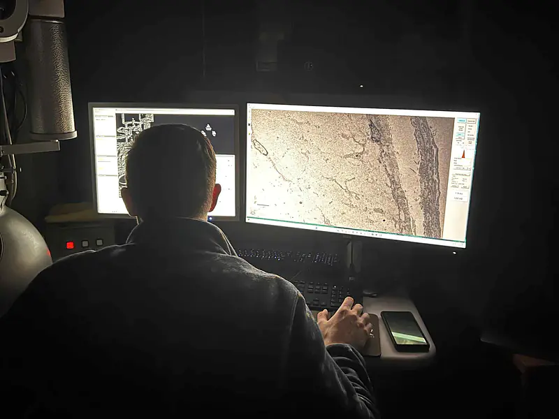 Exploring meningeal ultrastructure (2025)