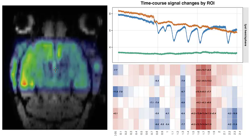 fMRI in Rodent Brain