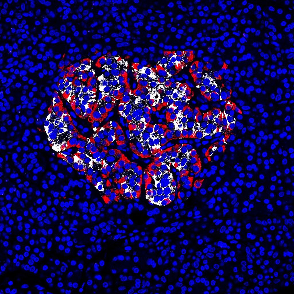 Human islet image showing the insulin producing (white) and glucagon producing (red) cells