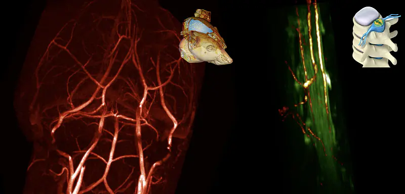 MR Angiography