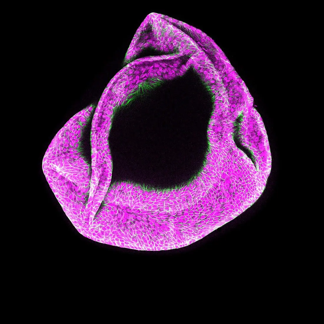Pancreatic ductal organoid image stained with cadherin (green) and DAPI as nuclear marker