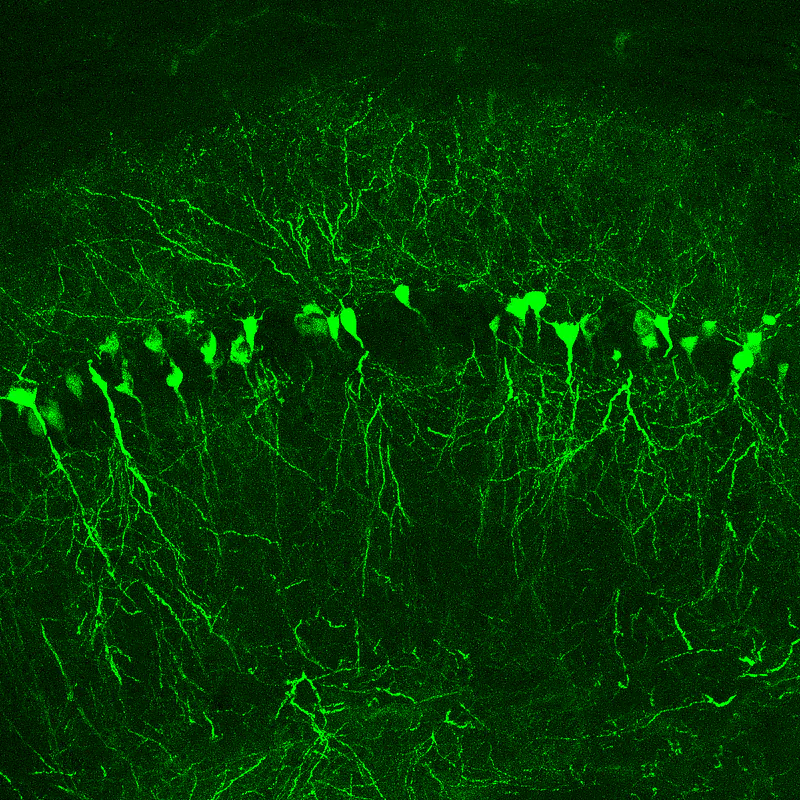 Hippocampal neurons labeled by In Utero electroporation 