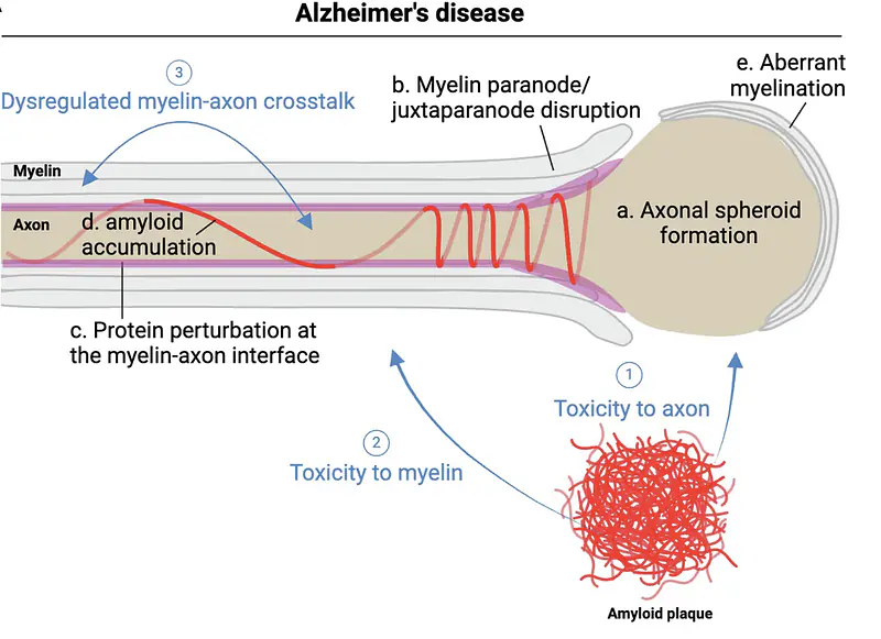Myelin-axon pathology in Alzheimer's disease