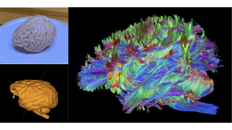 Baboon DTI 3D Tractography